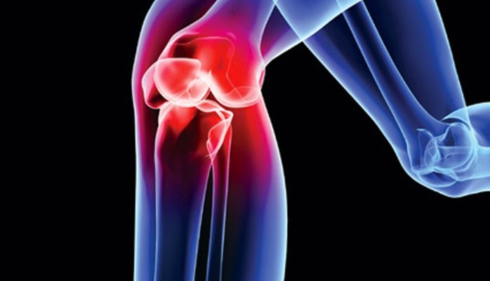 An x-ray mockup of a knee with some apparent injury, which is colored red, while the rest of the leg is colored blue.