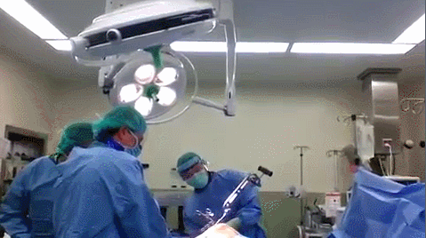 An animation of surgeons in an operating room forcefully hitting a metal implement that appears to be attached to a patient, but the metal object is out of frame and it is unclear what they're doing.
